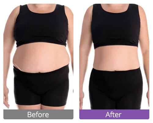 Quels sont les résultats de la machine s shape ?